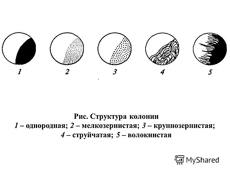 Колонии s типа. Структура колоний микроорганизмов. Структура колоний микробиология. Край колоний микроорганизмов. Строение колоний микроорганизмов.