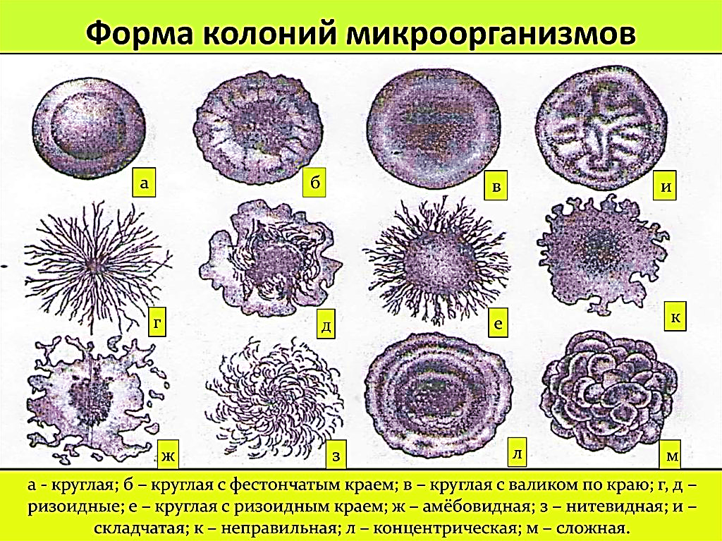 S форма бактерий. Фестончатые края колоний бактерий. Формы колоний бактерий. Типы колоний микроорганизмов. Типы колоний бактерий микробиология.