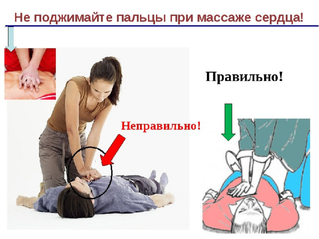 Расположение рук при проведении непрямого массажа сердца