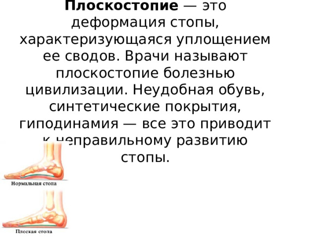 Чем может быть вызвано плоскостопие у человека