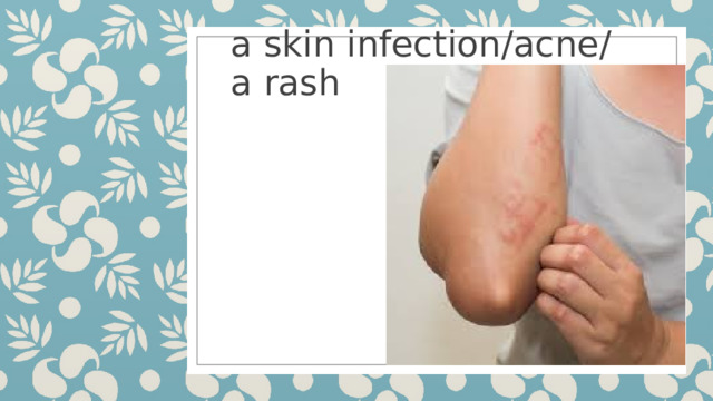 a skin infection/acne/  a rash 