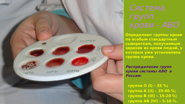 Система групп крови - АВО Определяют группы крови по особым стандартным сывороткам, получаемым заранее из крови людей, у которых уже установлена группа крови.  Распределение групп крови системы АВО в России:   группа О (I) – 35 %;  группа А (II) – 35-40 %;  группа В (III) – 15-20 %;  группа АВ (IV) – 5-10 %. 