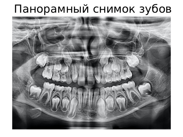 Панорамный снимок зубов Томск Родительская Панорамный снимок зубов Томск Чехова