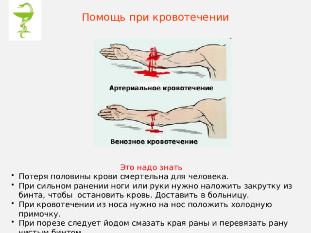 Помощь при кровотечении Это  надо  знать Потеря половины крови смертельна для человека. При сильном ранении ноги или руки нужно наложить закрутку из бинта, чтобы остановить кровь. Доставить в больницу. При кровотечении из носа нужно на нос положить холодную примочку. При порезе следует йодом смазать края раны и перевязать рану чистым бинтом. В сильную жару нельзя ходить с непокрытой головой. Потеря половины крови смертельна для человека. При сильном ранении ноги или руки нужно наложить закрутку из бинта, чтобы остановить кровь. Доставить в больницу. При кровотечении из носа нужно на нос положить холодную примочку. При порезе следует йодом смазать края раны и перевязать рану чистым бинтом. В сильную жару нельзя ходить с непокрытой головой. 