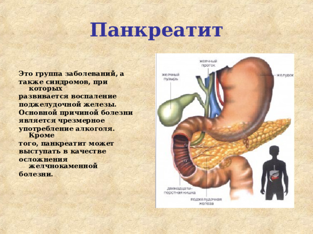 Панкреатит    Это группа заболеваний, а также синдромов, при которых развивается воспаление поджелудочной железы. Основной причиной болезни является чрезмерное употребление алкоголя. Кроме того, панкреатит может выступать в качестве осложнения желчнокаменной болезни.  