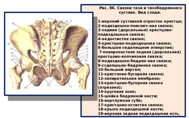 Рис. 86. Связки таза и тазобедренного сустава. Вид сзади.  1-верхний суставной отросток крестца; 2-подвздошно-пояснич-ная связка; 3-задиие (дорсальные) крестцово-подвздошные связки; 4-надостистая связка; 5-крестцово-подвздошная связка; 6-большое седалищное отверстие;  7-поверхностная задняя (дорсальная) крестцово-копчиковая связка; 8-подвздошно-бедрен-ная связка; 9-ссдапшцно-бедренная связка; 10-большой вертел; 11-крестново-бугорная связка; 12-запирательная мембрана; 13-крестцово-бугорная связка (отрезана); 14-круговая зона; 15-шейка бедренной кости; 16-вертлужная губа; 17-крестцово-остистая связка; 18-крыло подвздошной кости; 19-верхняя задняя подвздошная ость. 