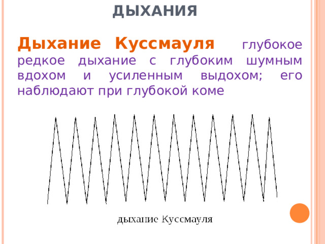 ПАТОЛОГИЧЕСКИЕ ТИПЫ ДЫХАНИЯ     Дыхание Куссмауля глубокое редкое дыхание с глубоким шумным вдохом и усиленным выдохом; его наблюдают при глубокой коме 