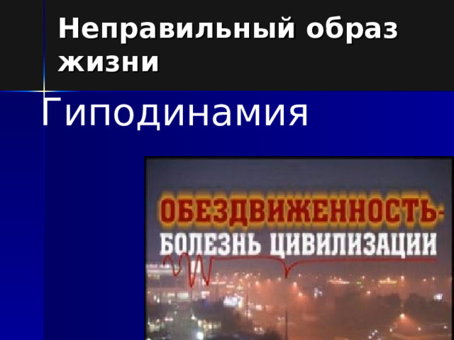 Неправильный образ жизни Гиподинамия 