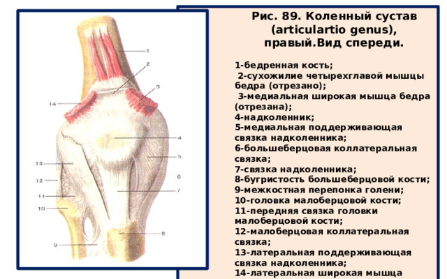 Рис. 89. Коленный сустав (articulartio genus), правый.Вид спереди.  1-бедренная кость;  2-сухожилие четырехглавой мышцы бедра (отрезано);  3-медиальная широкая мышца бедра (отрезана); 4-надколенник; 5-медиальная поддерживающая связка надколенника; 6-большеберцовая коллатеральная связка; 7-связка надколенника; 8-бугристость большеберцовой кости; 9-межкостная перепонка голени; 10-головка малоберцовой кости; 11-передняя связка головки малоберцовой кости; 12-малоберцовая коллатеральная связка; 13-латеральная поддерживающая связка надколенника; 14-латеральная широкая мышца бедра (отрезана). 