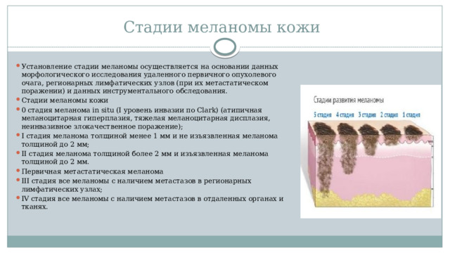 Стадии меланомы кожи   Установление стадии меланомы осуществляется на основании данных морфологического исследования удаленного первичного опухолевого очага, регионарных лимфатических узлов (при их метастатическом поражении) и данных инструментального обследования. Стадии меланомы кожи 0 стадия меланома in situ (I уровень инвазии по Clark) (атипичная меланоцитарная гиперплазия, тяжелая меланоцитарная дисплазия, неинвазивное злокачественное поражение); I стадия меланома толщиной менее 1 мм и не изъязвленная меланома толщиной до 2 мм; II стадия меланома толщиной более 2 мм и изъязвленная меланома толщиной до 2 мм. Первичная метастатическая меланома III стадия все меланомы с наличием метастазов в регионарных лимфатических узлах; IV стадия все меланомы с наличием метастазов в отдаленных органах и тканях. 