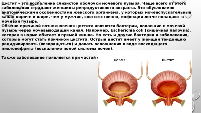 Мочеиспускательный канал у женщин