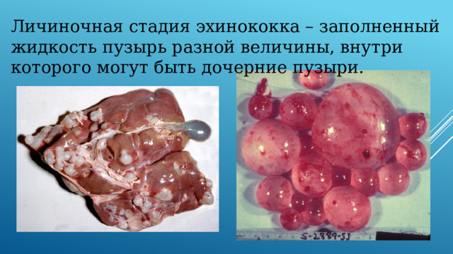 Личиночная стадия эхинококка – заполненный жидкость пузырь разной величины, внутри которого могут быть дочерние пузыри. 