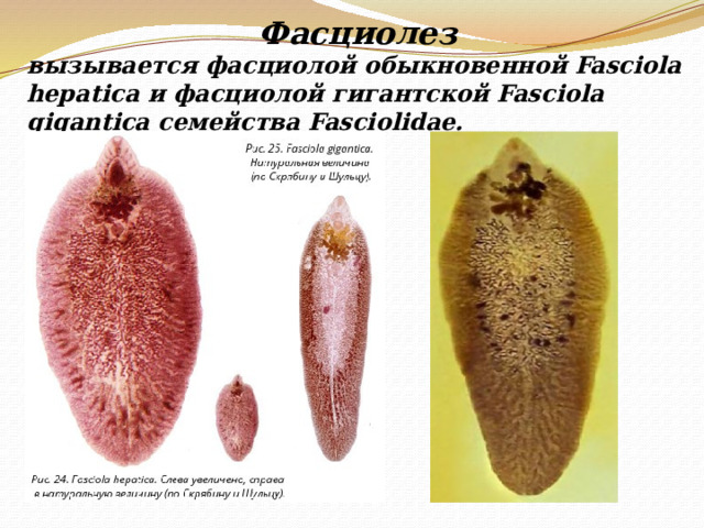 Фасциолез  вызывается фасциолой обыкновенной Fasciola hepatica и фасциолой гигантской Fasciola gigantica семейства Fasciolidae. 