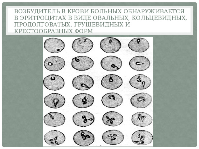 Возбудитель в крови больных обнаруживается в эритроцитах в виде овальных, кольцевидных, продолговатых, грушевидных и крестообразных форм 