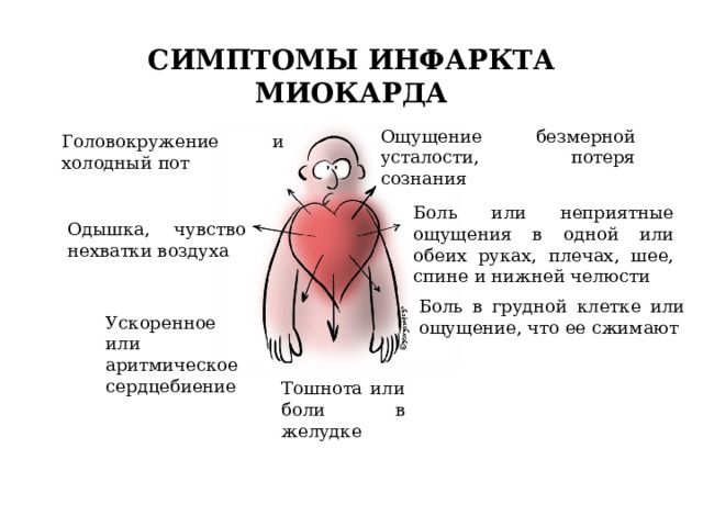 Боль при инфаркте. Боль при инфаркте миокарда. Признаки инфаркта у женщины 35 лет.