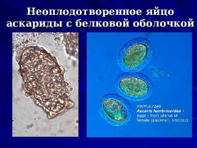 Яйцо аскариды рисунок