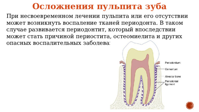 Осложнения пульпита зуба При несвоевременном лечении пульпита или его отсутствии может возникнуть воспаление тканей периодонта. В таком случае развивается периодонтит, который впоследствии может стать причиной периостита, остеомиелита и других опасных воспалительных заболеваний. 