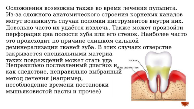 Осложнения возможны также во время лечения пульпита. Из-за сложного анатомического строения корневых каналов могут возникнуть случаи поломки инструментов внутри них. Довольно часто их удаётся извлечь. Также может произойти перфорация дна полости зуба или его стенок. Наиболее часто это происходит по причине слишком сильной деминерализации тканей зуба. В этих случаях отверстие закрывается специальными материалами, но иногда итогом таких повреждений может стать удаление зуба. Неправильно поставленный диагноз и, как следствие, неправильно выбранный метод лечения (например, несоблюдение времени постановки мышьяковистой пасты и прочее) 