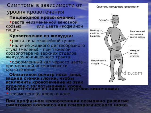 Симптомы в зависимости от уровня кровотечения Пищеводное кровотечение:  рвота неизмененной венозной кровью или цвета «кофейной гущи».  Кровотечение из желудка:  рвота типа «кофейной гущи» наличие жидкого дегтеобразного стула (мелены) – при тяжелой кровопотере из верхних отделов желудочно-кишечного тракта. оформленный кал черного цвета – при меньшей интенсивности кровотечения. Обязателен осмотр носа зева, задней стенки глотки, чтобы исключить кровотечение из этих отделов с заглатыванием крови.  Кровотечение из нижних отделов кишечника: неизмененная кровь в кале. При профузном кровотечении возможно развитие симптомов коллапса или геморрагического шока. 