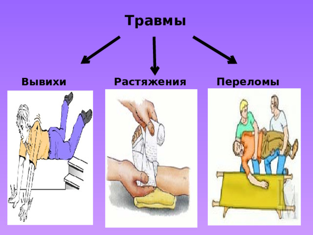 Травмы   Вывихи Растяжения  Переломы 