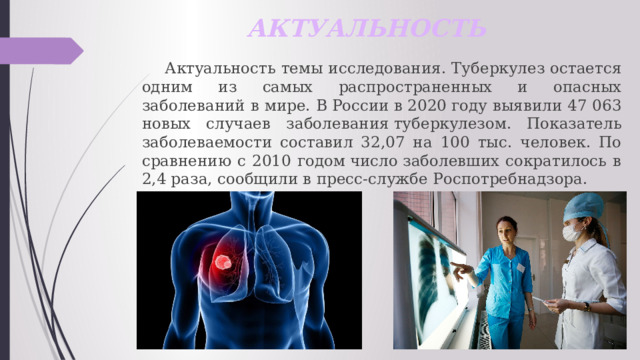 АКТУАЛЬНОСТЬ  Актуальность темы исследования. Туберкулез остается одним из самых распространенных и опасных заболеваний в мире. В России в 2020 году выявили 47 063 новых случаев заболевания туберкулезом. Показатель заболеваемости составил 32,07 на 100 тыс. человек. По сравнению с 2010 годом число заболевших сократилось в 2,4 раза, сообщили в пресс-службе Роспотребнадзора. 