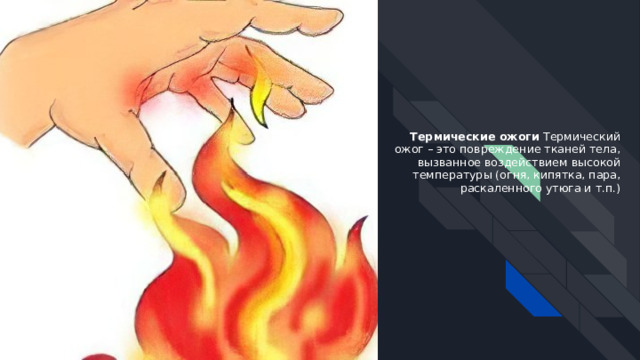 Термические ожоги Термический ожог – это повреждение тканей тела, вызванное воздействием высокой температуры (огня, кипятка, пара, раскаленного утюга и т.п.) 