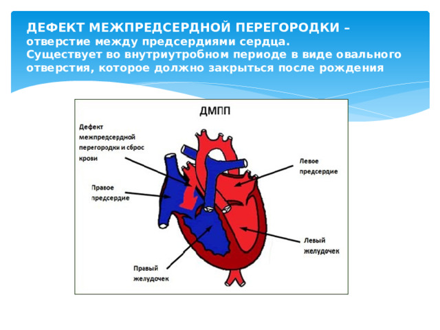 Дефект межпредсердной перегородки ответы нмо