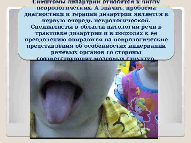 Симптомы дизартрии относятся к числу неврологических. А значит, проблема диагностики и терапии дизартрии является в первую очередь неврологической. Специалисты в области патологии речи в трактовке дизартрии и в подходах к ее преодолению опираются на неврологические представления об особенностях иннервации речевых органов со стороны соответствующих мозговых структур.   