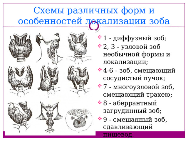 Схемы различных форм и особенностей локализации зоба 1 - диффузный зоб; 2, 3 - узловой зоб необычной формы и локализации; 4-6 - зоб, смещающий сосудистый пучок; 7 - многоузловой зоб, смещающий трахею; 8 - аберрантный загрудинный зоб; 9 - смешанный зоб, сдавливающий пищевод. 