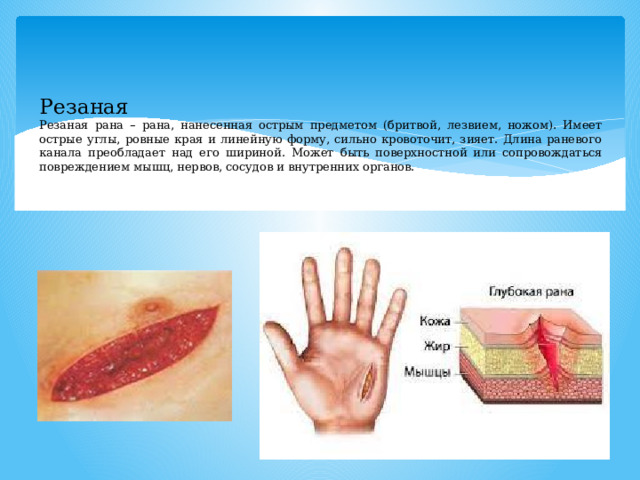 Резаная  Резаная рана – рана, нанесенная острым предметом (бритвой, лезвием, ножом). Имеет острые углы, ровные края и линейную форму, сильно кровоточит, зияет. Длина раневого канала преобладает над его шириной. Может быть поверхностной или сопровождаться повреждением мышц, нервов, сосудов и внутренних органов. 