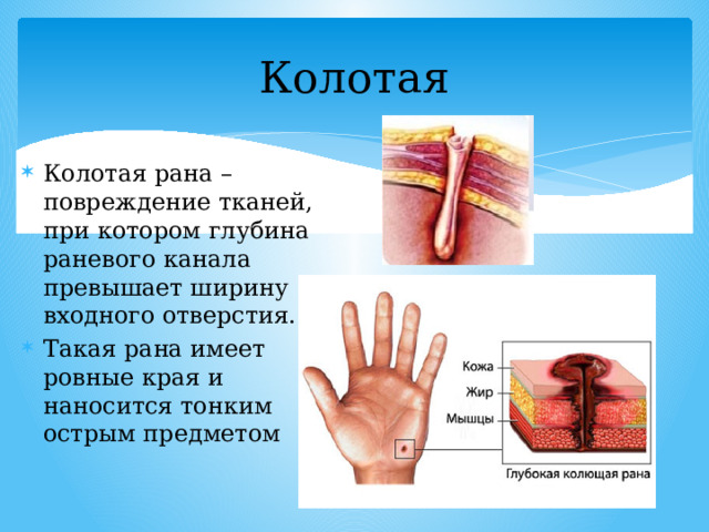 Колотая Колотая рана – повреждение тканей, при котором глубина раневого канала превышает ширину входного отверстия. Такая рана имеет ровные края и наносится тонким острым предметом 