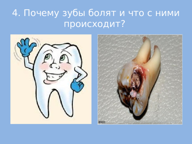 4. Почему зубы болят и что с ними происходит?  