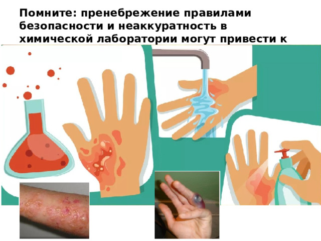 Помните: пренебрежение правилами безопасности и неаккуратность в химической лаборатории могут привести к реальным травмам !  