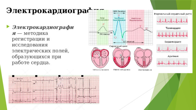 Электрокардиография Электрокардиография — методика регистрации и исследования электрических полей, образующихся при работе сердца. 