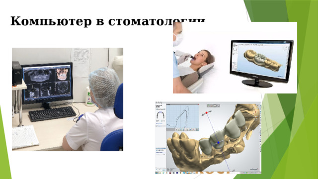 Компьютер в стоматологии 