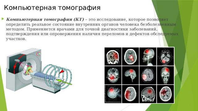 Кт это для чего. Компьютерная томография презентация. Компьютерная томография презентация в медицине. Компьютерная томография позволяет выявить. Методы современной томографии физиология.