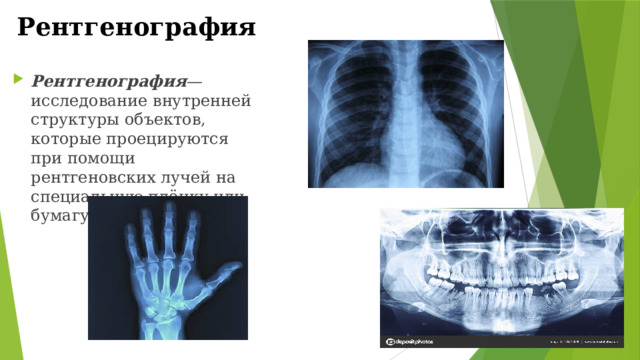 Рентгенография Рентгенография — исследование внутренней структуры объектов, которые проецируются при помощи рентгеновских лучей на специальную плёнку или бумагу. 