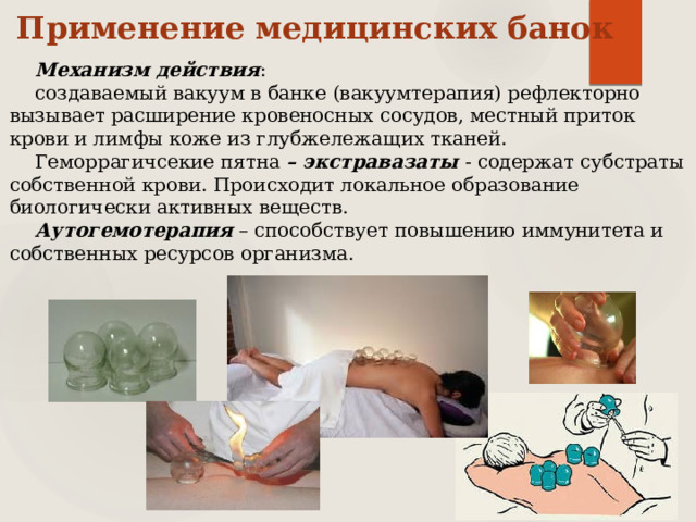 Применение медицинских банок Механизм действия : создаваемый вакуум в банке (вакуумтерапия) рефлекторно вызывает расширение кровеносных сосудов, местный приток крови и лимфы коже из глубжележащих тканей. Геморрагичсекие пятна – экстравазаты  - содержат субстраты собственной крови. Происходит локальное образование биологически активных веществ. Аутогемотерапия – способствует повышению иммунитета и собственных ресурсов организма. 