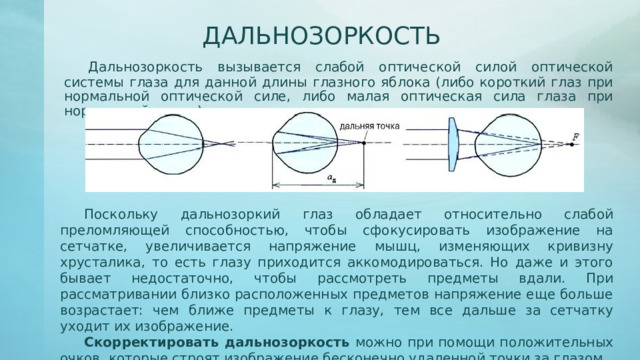 Человек носит очки оптическая сила которых 4