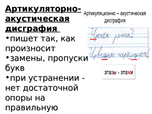 Артикуляторно-акустическая дисграфия пишет так, как произносит замены, пропуски букв при устранении - нет достаточной опоры на правильную артикуляцию 
