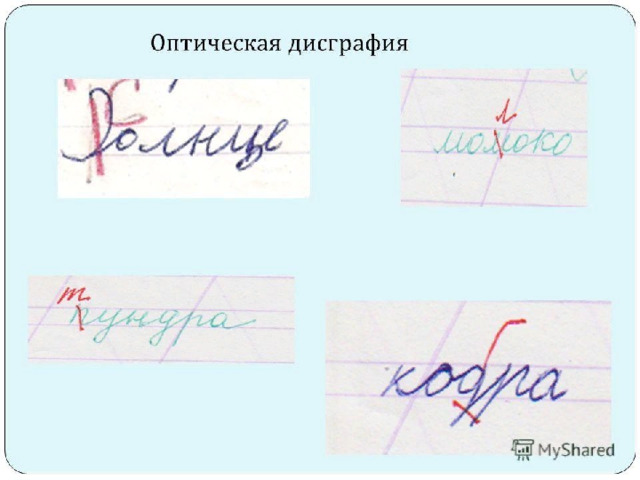 Оптическая дисграфия 