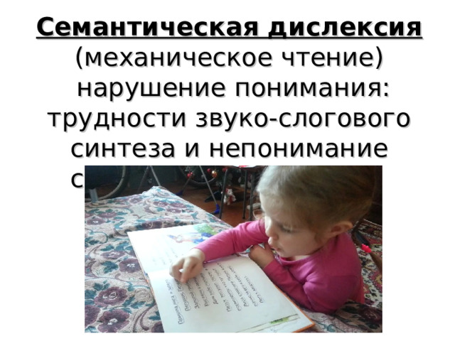 Семантическая дислексия (механическое чтение)  нарушение понимания: трудности звуко-слогового синтеза и непонимание синтаксических связей 