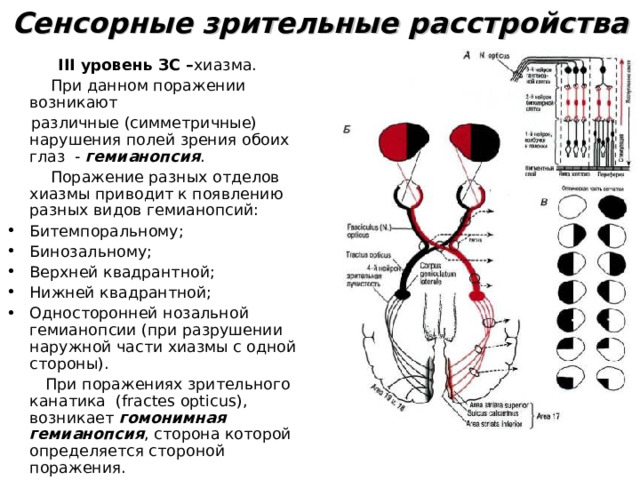 Зрительные расстройства это. Поражение хиазмы. Зрительные расстройства. Расстройства зрения при поражении хиазмы. Гемианопсия.