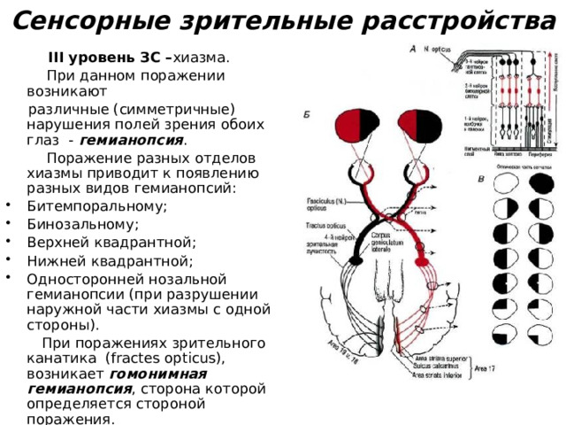 "Сенсорные расстройства" - Логопедия - Презентации