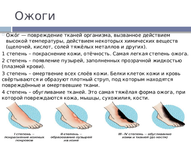 Ожоги Ожо́г — повреждение тканей организма, вызванное действием высокой температуры, действием некоторых химических веществ (щелочей, кислот, солей тяжёлых металлов и других). 1 степень – покраснение кожи, отёчность. Самая легкая степень ожога. 2 степень – появление пузырей, заполненных прозрачной жидкостью (плазмой крови). 3 степень – омертвение всех слоёв кожи. Белки клеток кожи и кровь свёртываются и образуют плотный струп, под которым находятся повреждённые и омертвевшие ткани. 4 степень – обугливание тканей. Это самая тяжёлая форма ожога, при которой повреждаются кожа, мышцы, сухожилия, кости. 