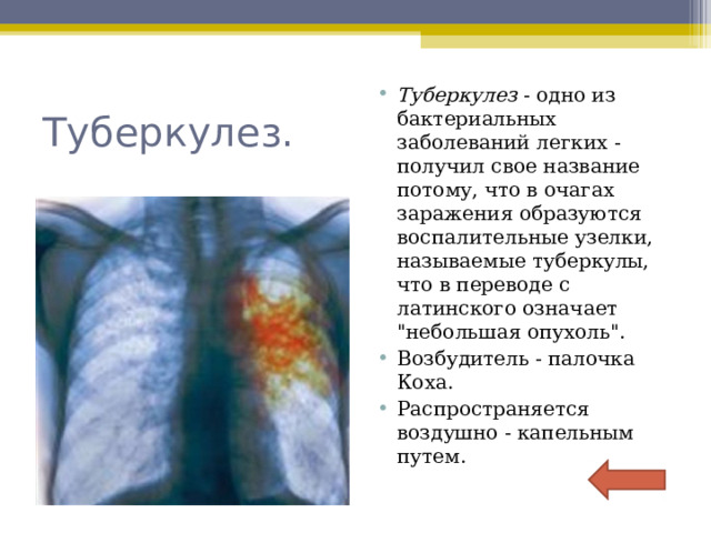 Туберкулез - одно из бактериальных заболеваний легких - получил свое название потому, что в очагах заражения образуются воспалительные узелки, называемые туберкулы, что в переводе с латинского означает 
