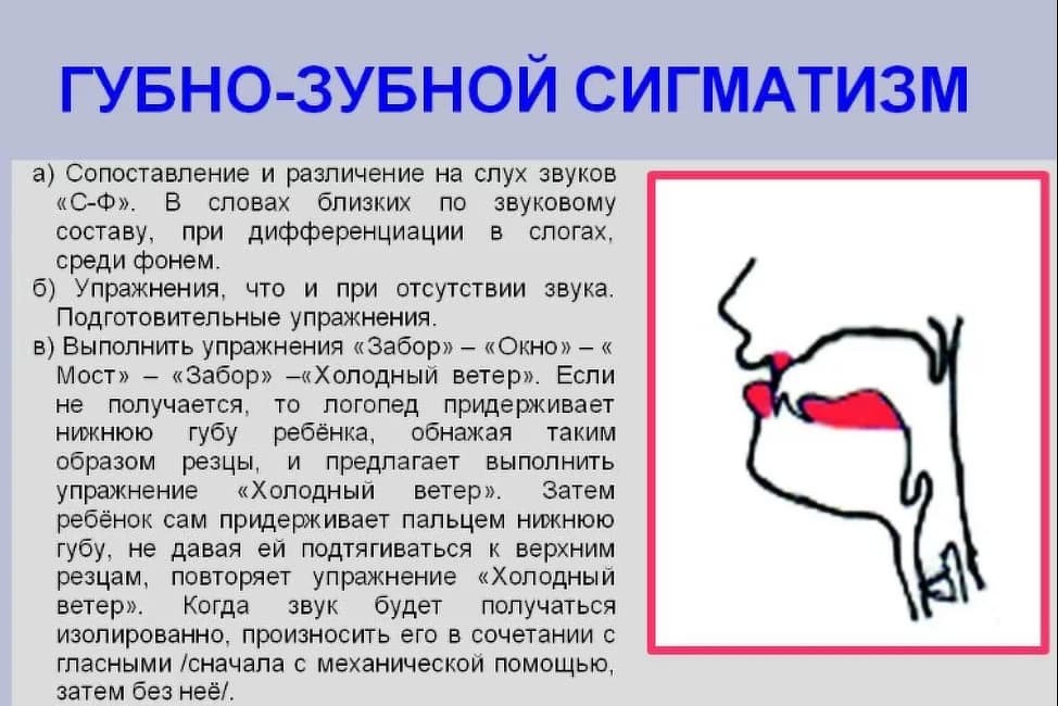 План логопедической работы по преодолению нарушения звукопроизношения межзубный сигматизм