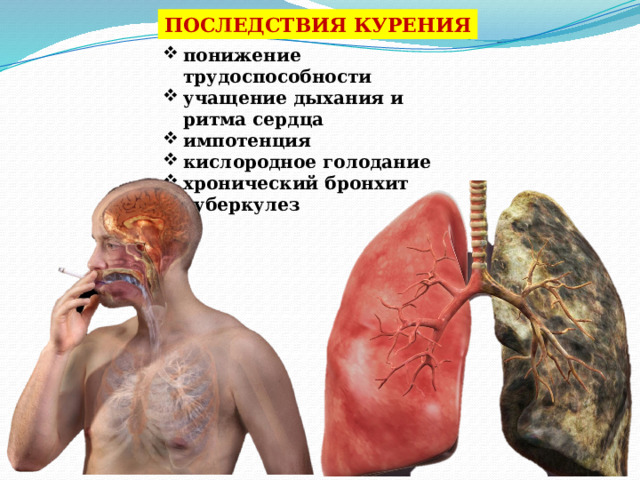 ПОСЛЕДСТВИЯ КУРЕНИЯ понижение трудоспособности учащение дыхания и ритма сердца импотенция кислородное голодание хронический бронхит туберкулез 