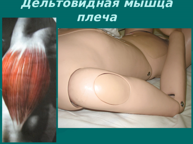 Дельтовидная мышца плеча 