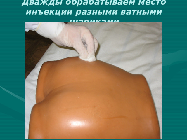 Дважды обрабатываем место инъекции разными ватными шариками 